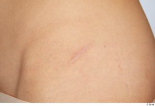 Cynthia nude scar skin 0003.jpg